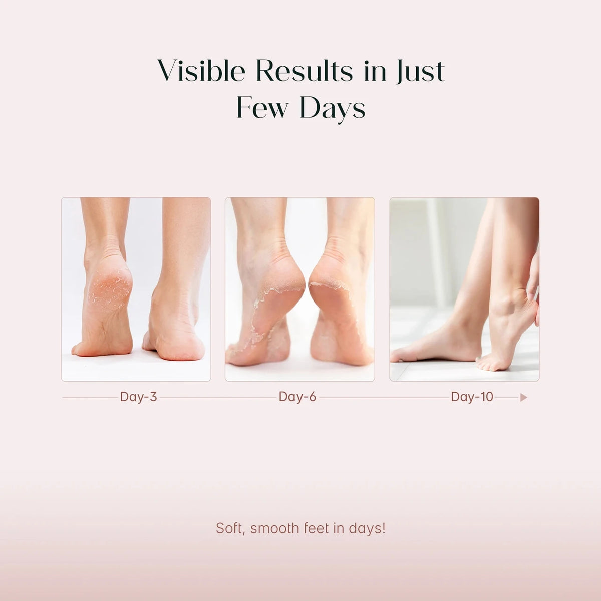 JEVONS Glycolic Acid Foot Peeling Mask | Exfoliating Foot Mask for Dry, Rough & Dead Skin | Soft & Smooth Feet Care | 1 Pair (40g)