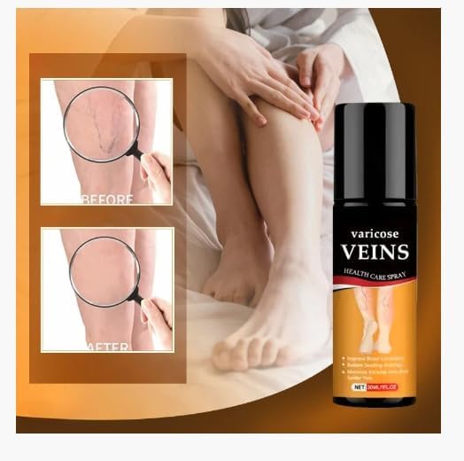 Vericose Vein Pain Relief spray